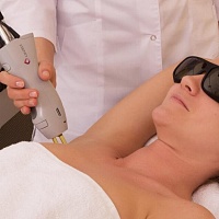 ЛАЗЕРНАЯ ЭПИЛЯЦИЯ